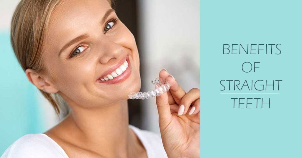 OKC Dentist: Benefits of Straight Teeth - Pragma Dental OKC